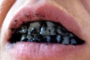 Activated Charcoal for Teeth Whitening